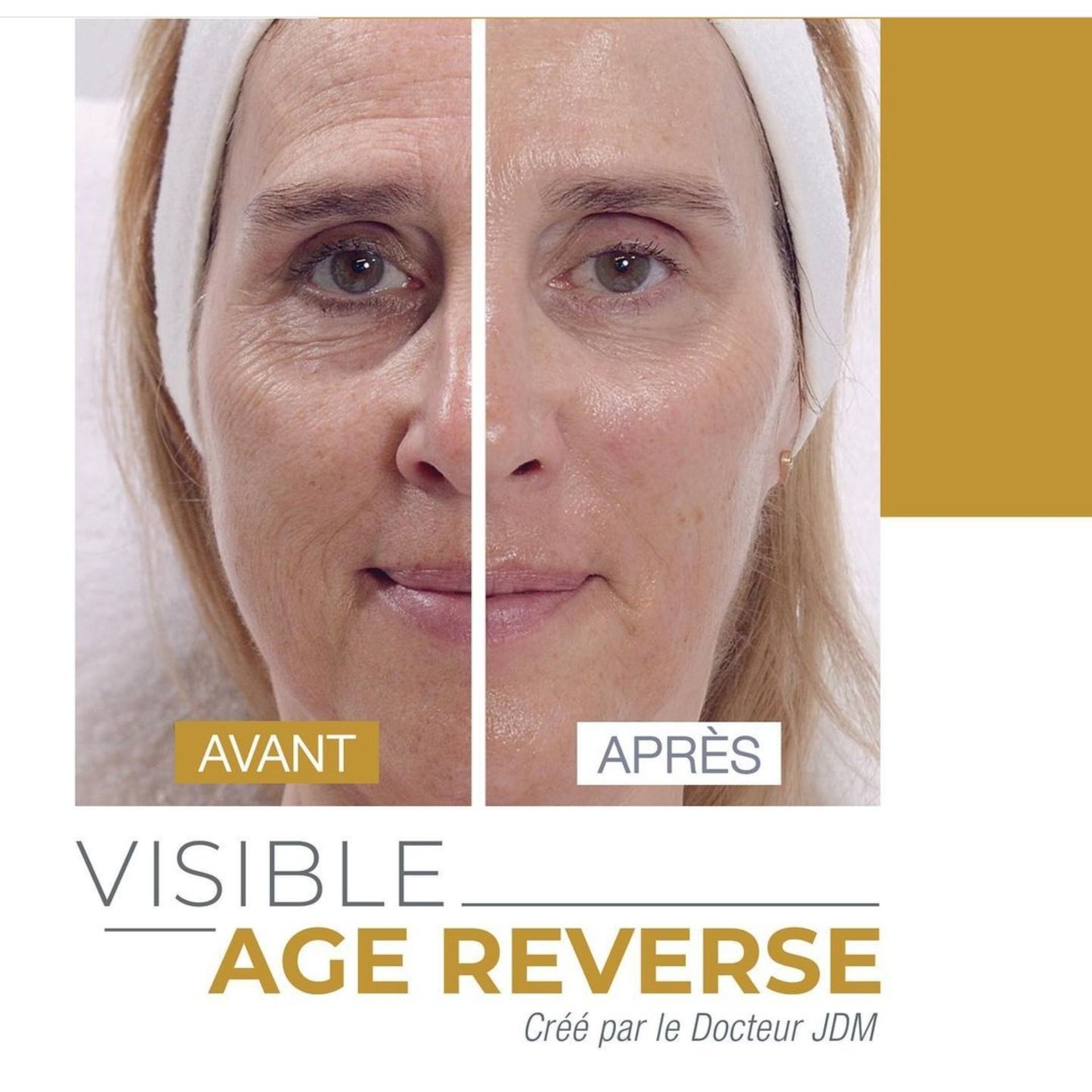 Avant et après d'un visage avec le traitement Age Reverse