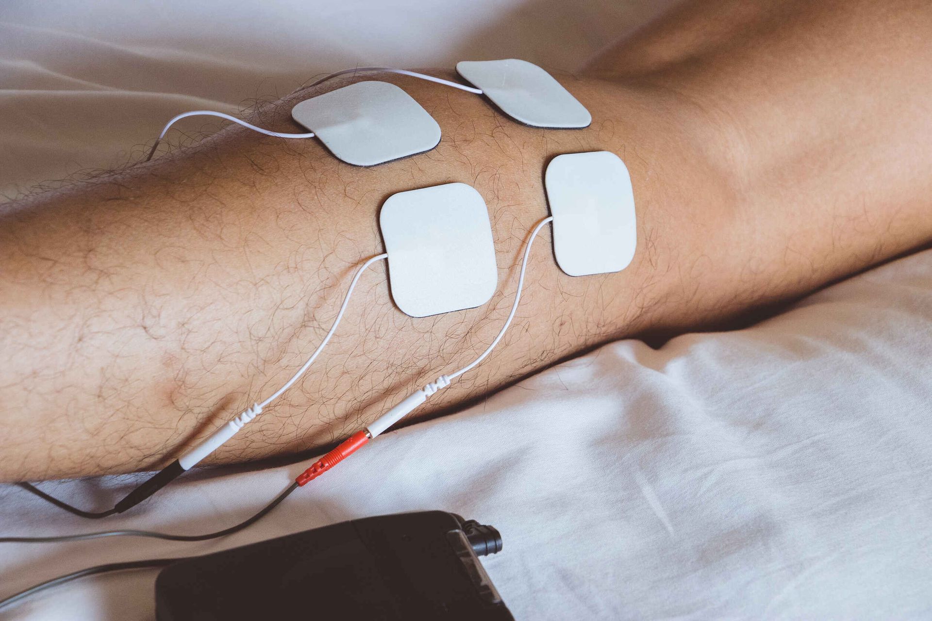 Una persona está acostada en una cama con electrodos en la pierna.