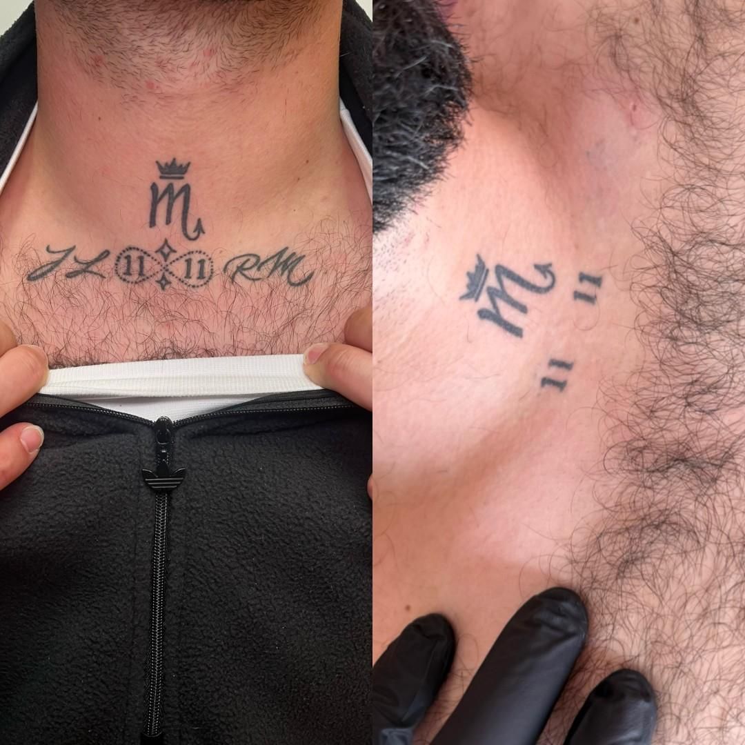 Dos fotos que muestran tatuajes en el cuello y el pecho de la misma persona. Los tatuajes incluyen la letra M, una corona y números romanos.