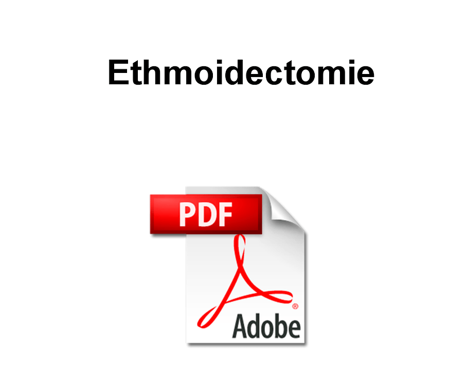 Ethmoidectomie