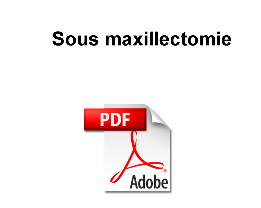 Sous Maxillectomie