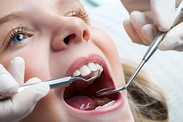 Soins dentaires pédiatriques - Cabinet dentaire Freesia Alba - Lausanne