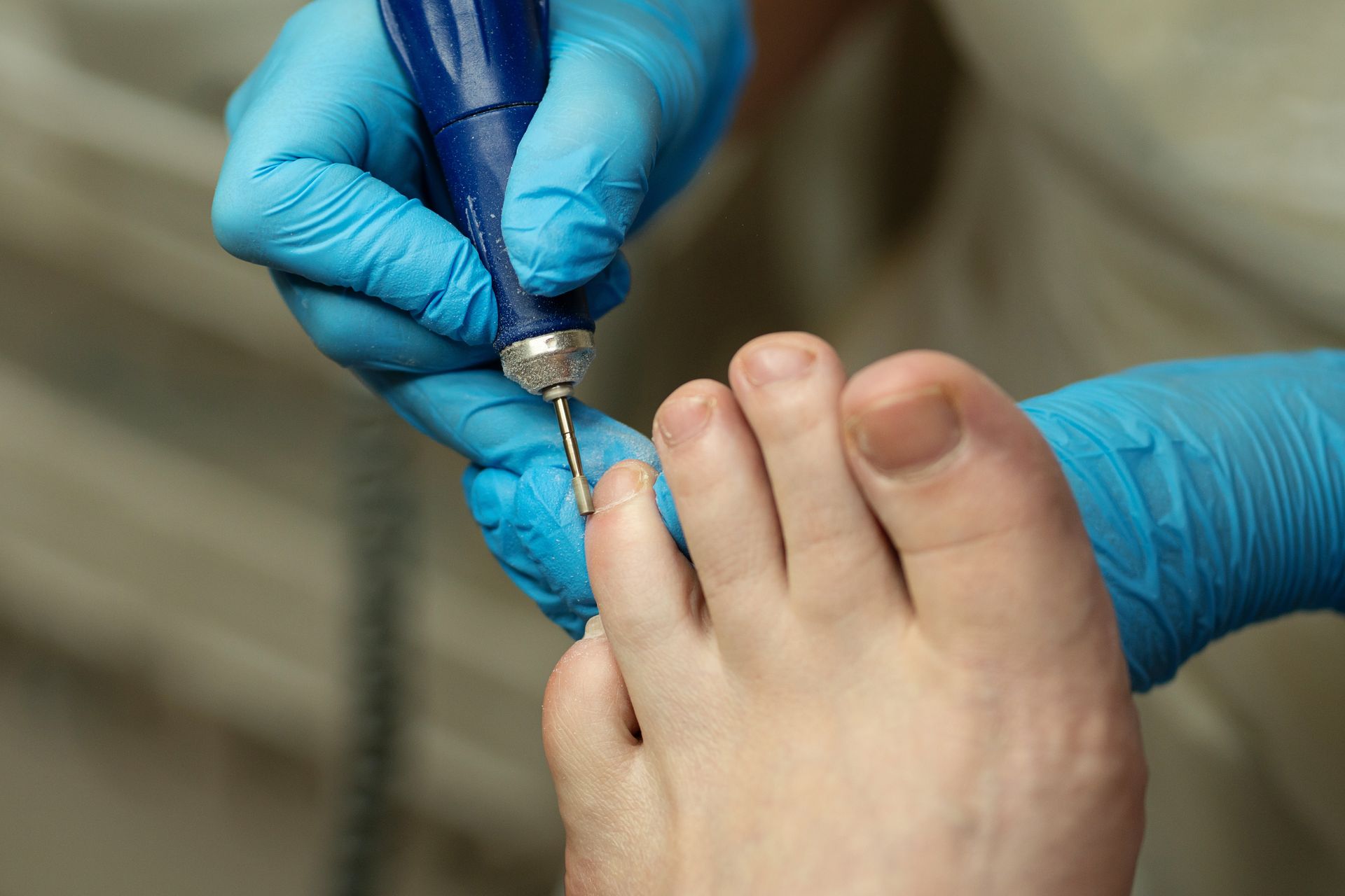 Pied d'une personne recevant un soin des ongles avec un outil à manche bleu ; mains gantées en gros plan.
