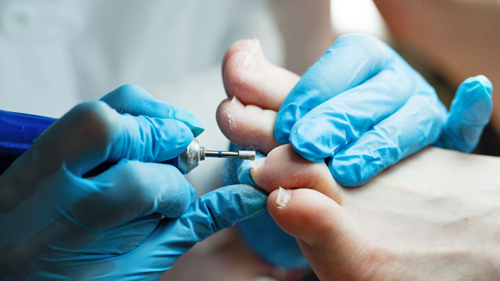 Des mains gantées de bleus utilisent un outil sur un pied, probablement pour couper les ongles des orteils.