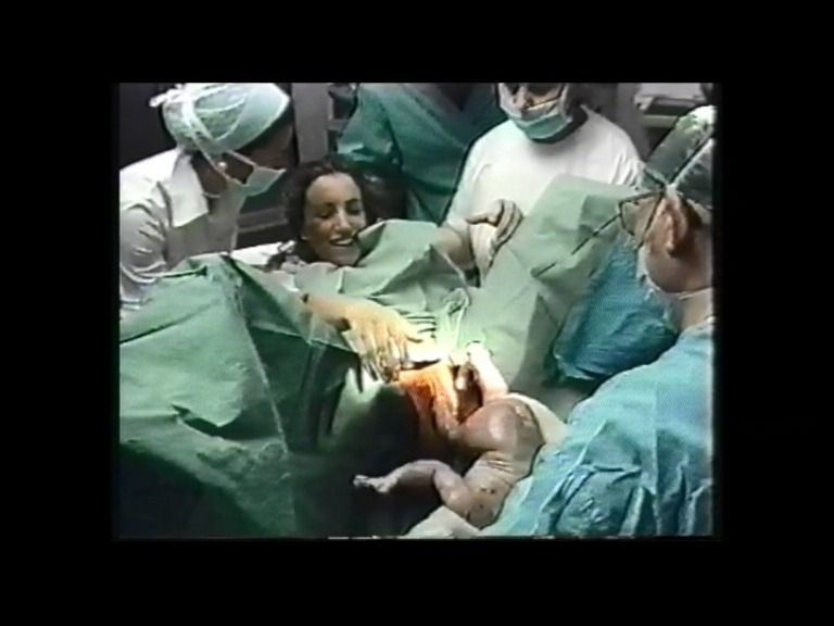 Mujer dando a luz, sonriendo, rodeada de personal médico en el quirófano de un hospital.