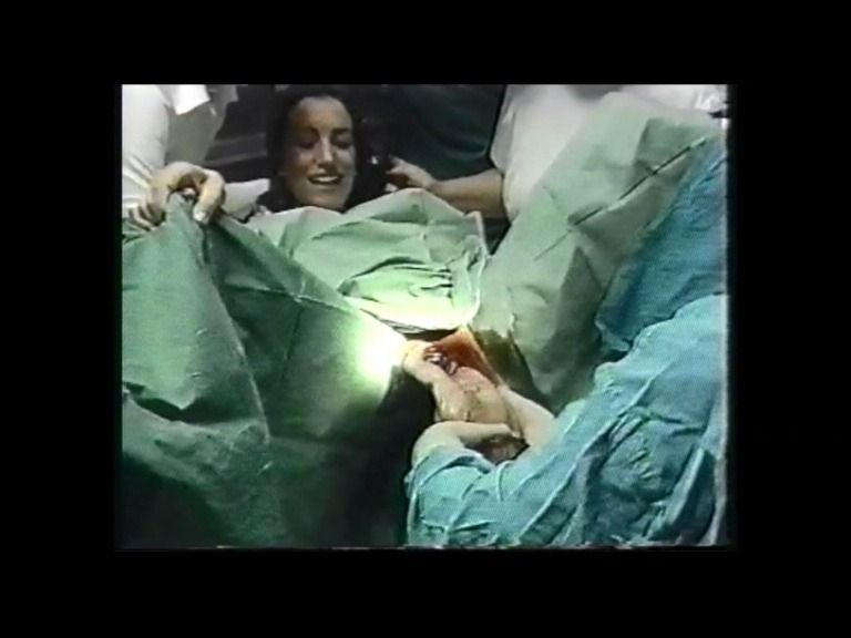 Mujer dando a luz en un entorno hospitalario, rodeada de personal médico.