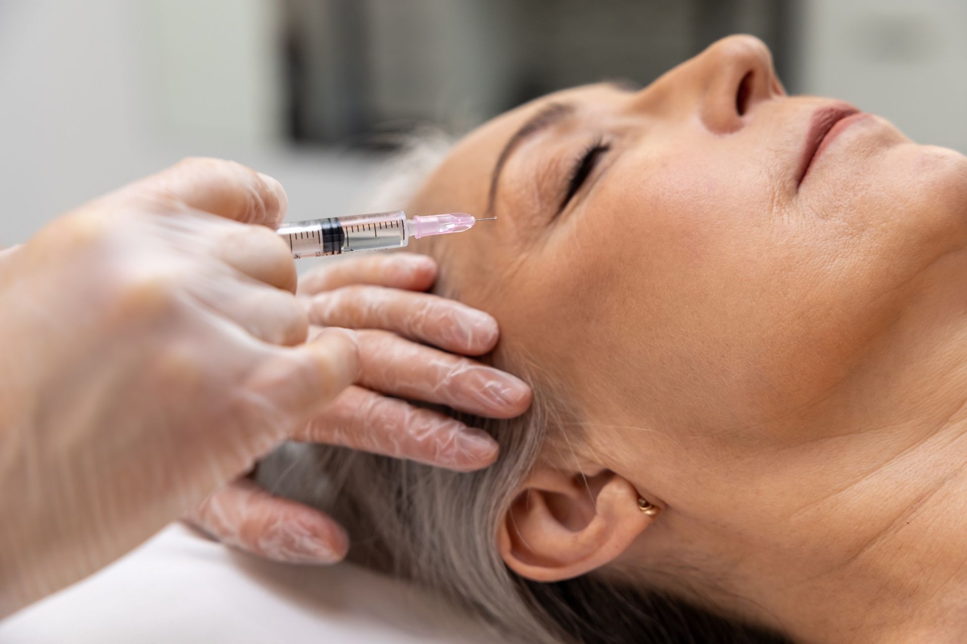 Una mujer recibe una inyección de botox en la frente.