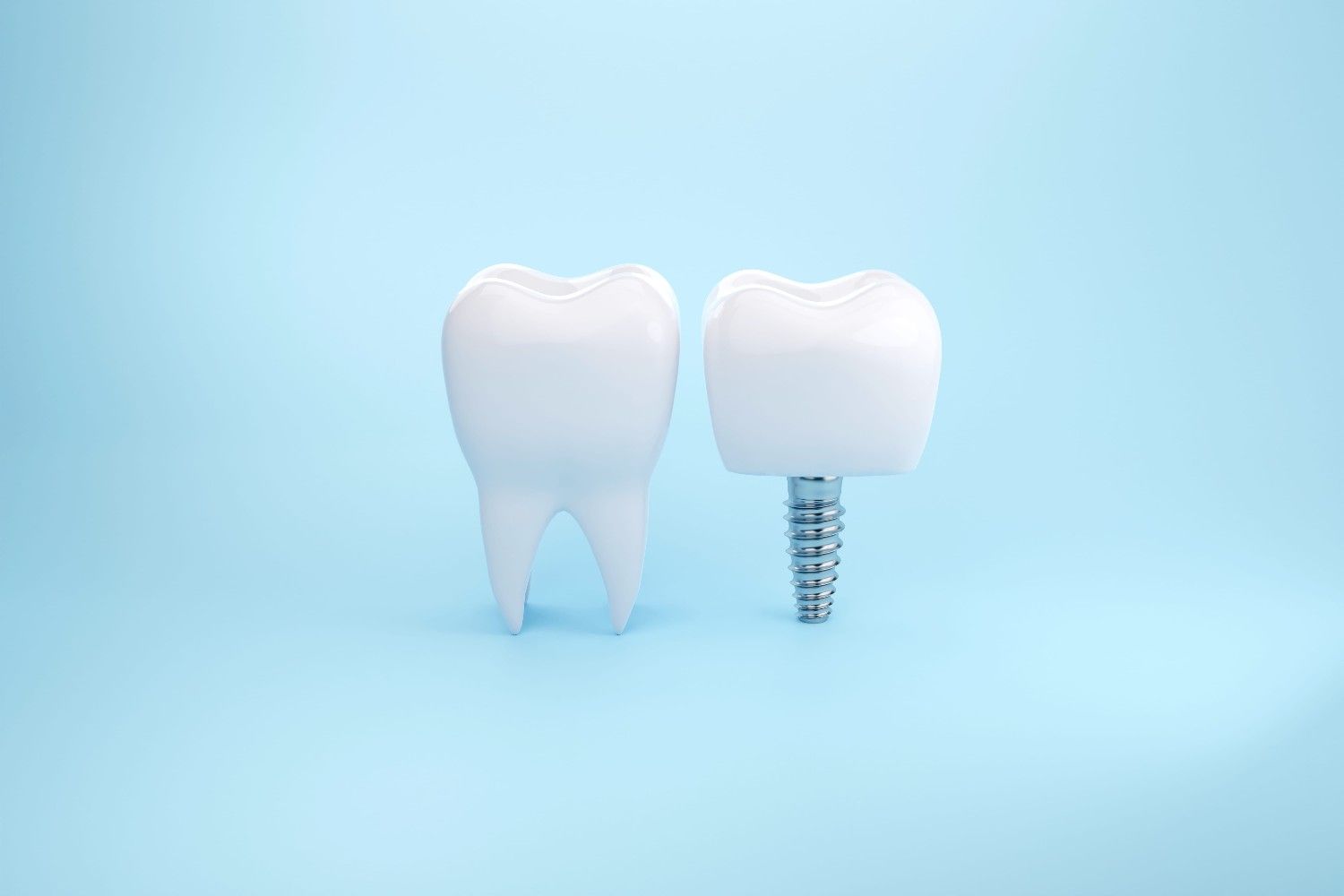 Dos implantes dentales blancos sobre un fondo azul claro, uno de ellos con un vástago de tornillo metálico visible.
