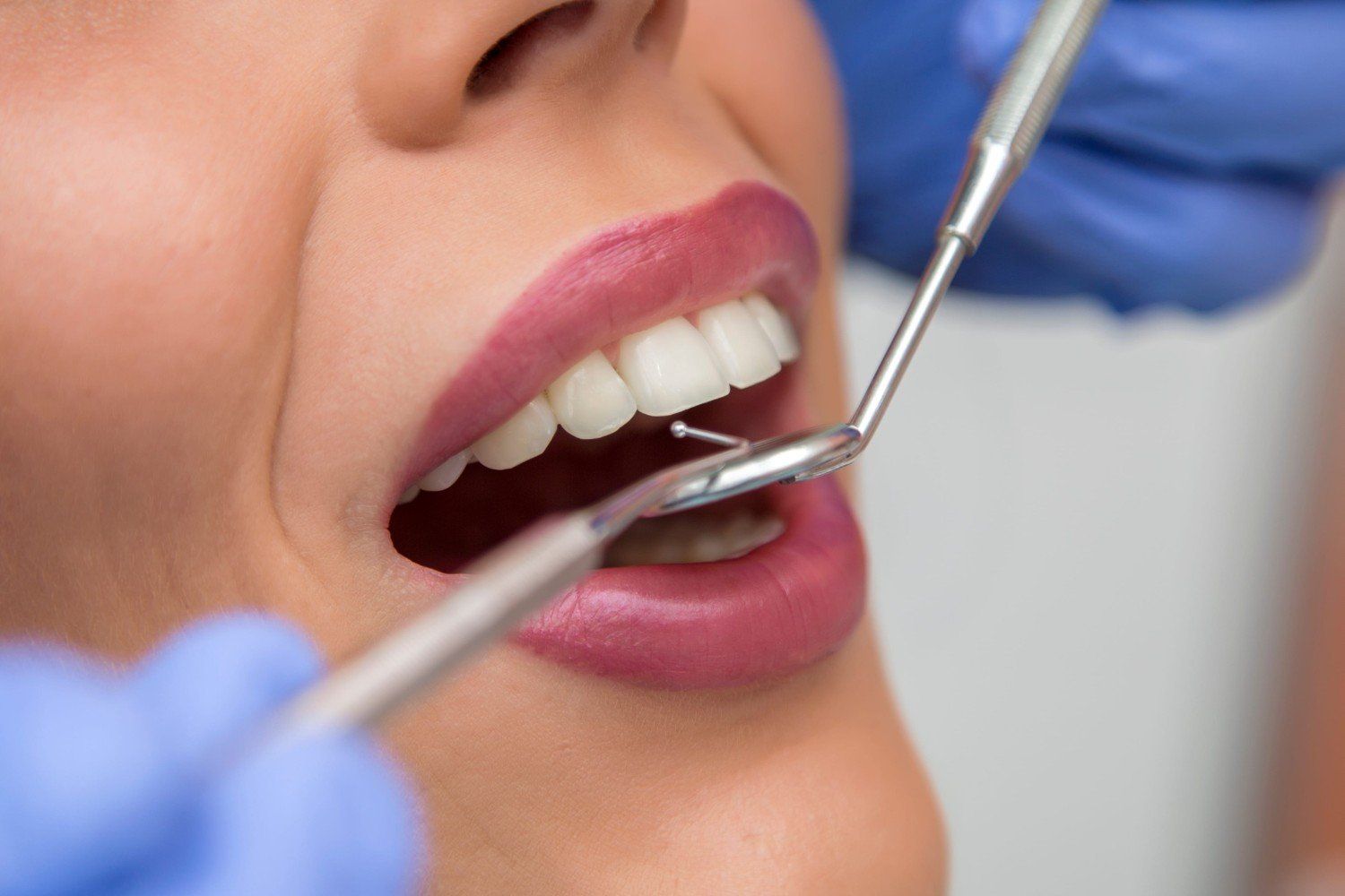 Odontólogo examinando los dientes de un paciente con un espejo y una sonda en un examen dental de cerca.