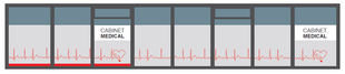 Bandes ECG avec étiquettes : « PASE-1 » et « CH 18 Pad L/F ».