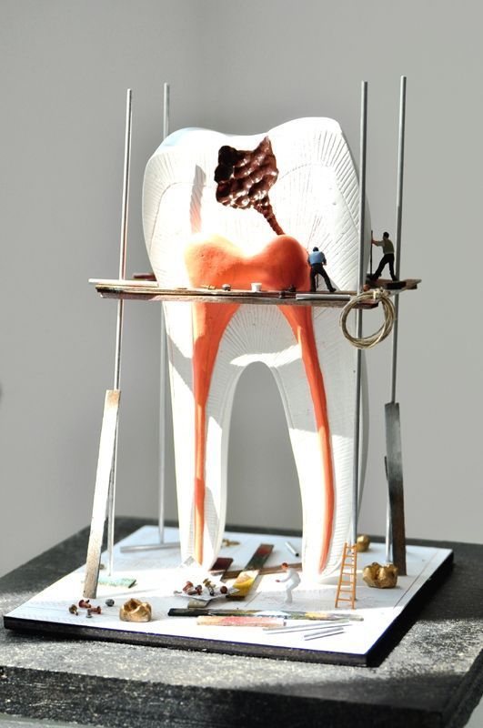 Zahnmodell in Übergröße