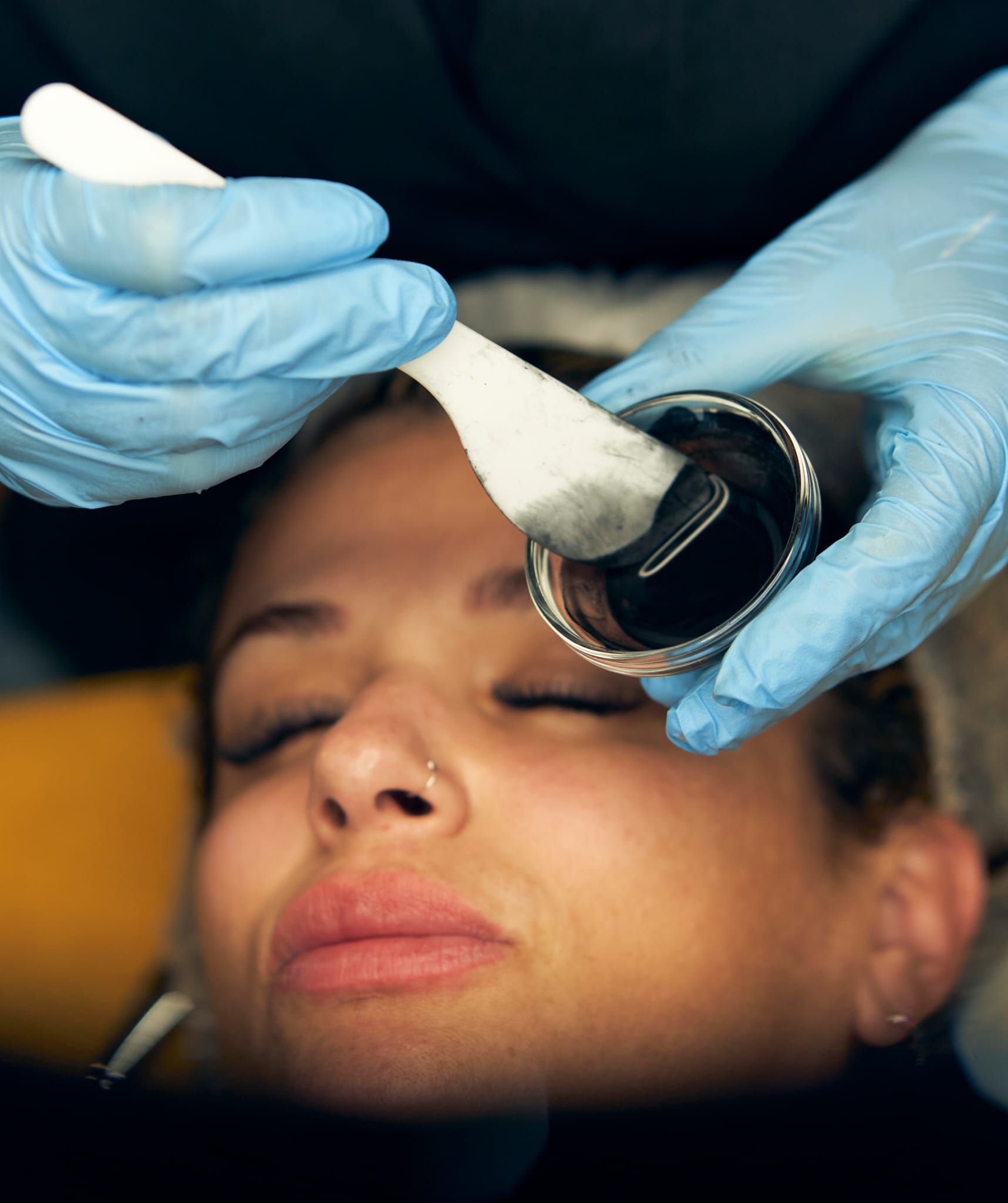 Persona que recibe un tratamiento facial, con las manos enguantadas aplicando una sustancia oscura de un frasco.