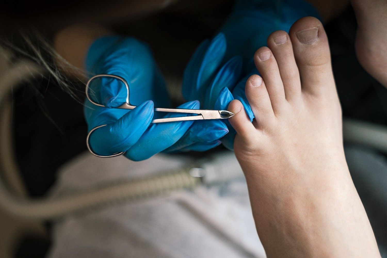 Pie de una persona con el dedo gordo recortado con tijeras sostenidas en manos enguantadas.