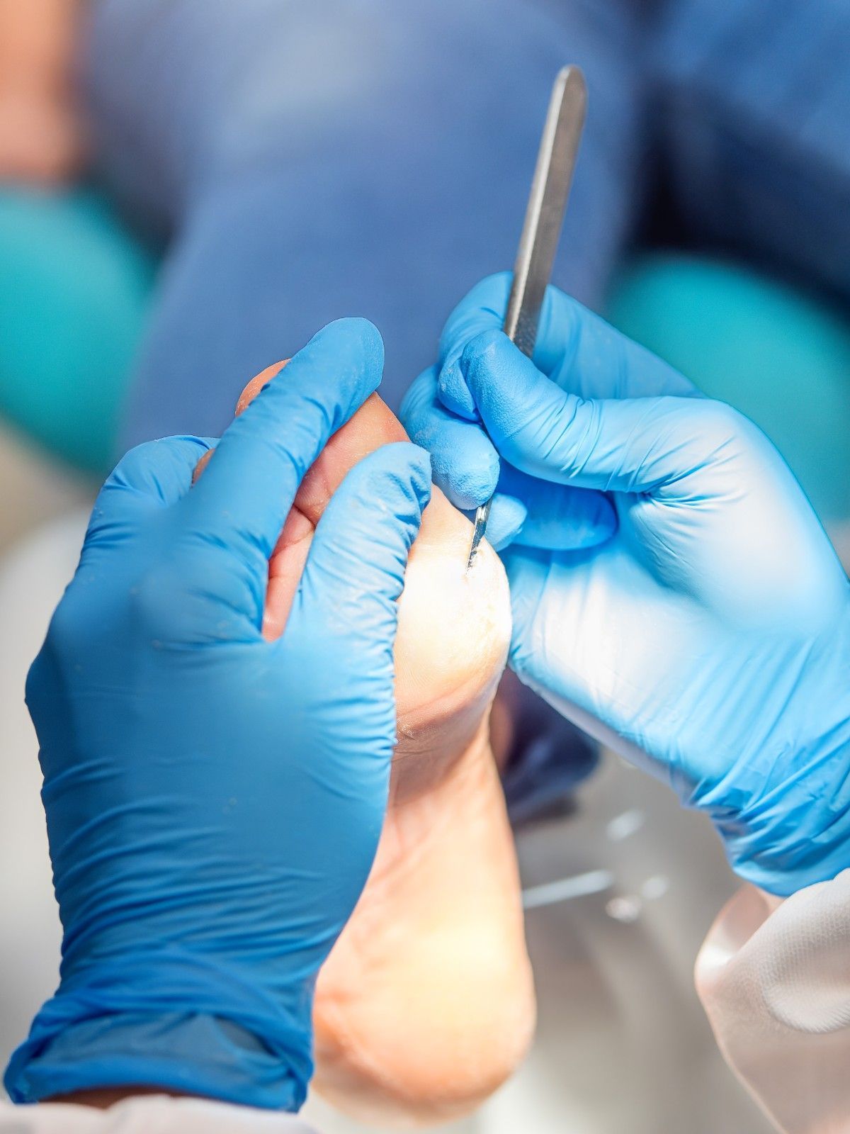 Manos con guantes azules utilizando una herramienta médica en un pie.
