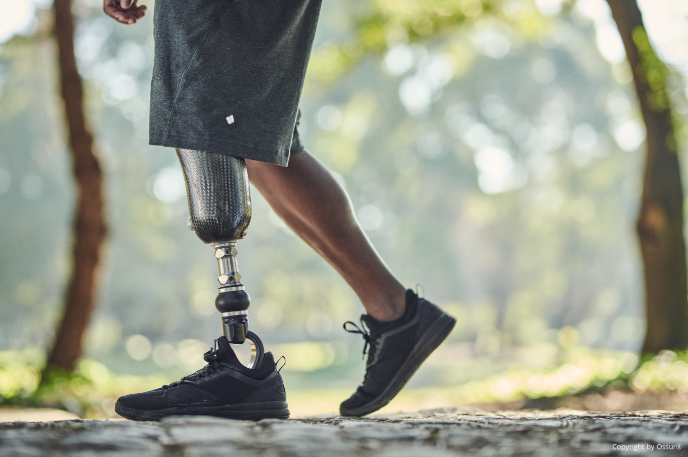 Reidl Orthopädietechnik GbR - Frau mit orthopädischer Beinschiene auf einer Liege