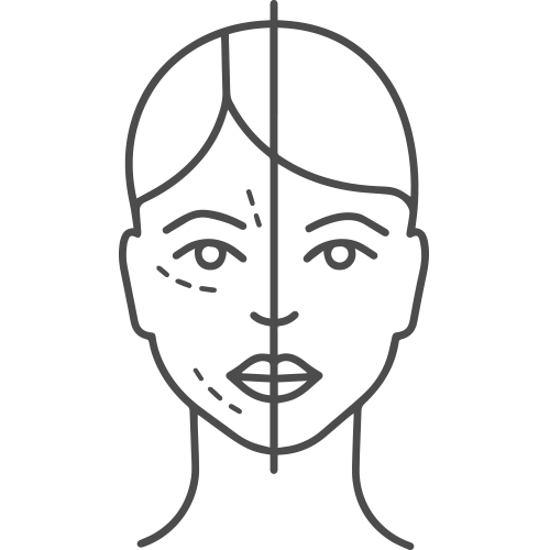 Un dibujo lineal del rostro de una mujer antes y después de la cirugía plástica.
