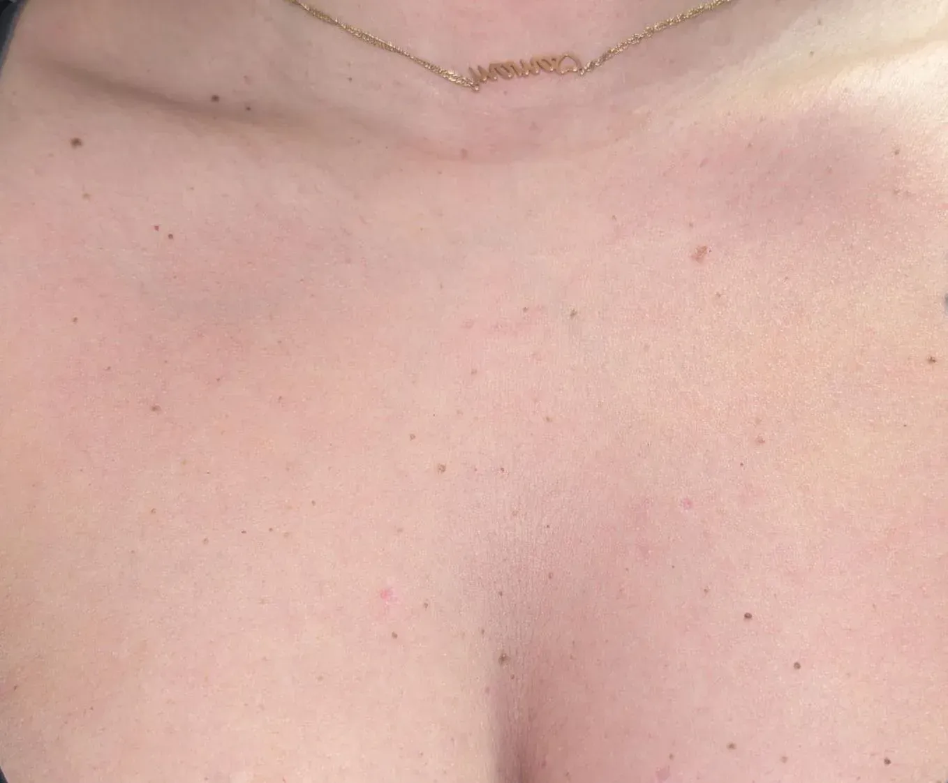 Primer plano del pecho y el cuello de una persona con un collar de oro. La piel presenta pequeñas pecas y lunares.