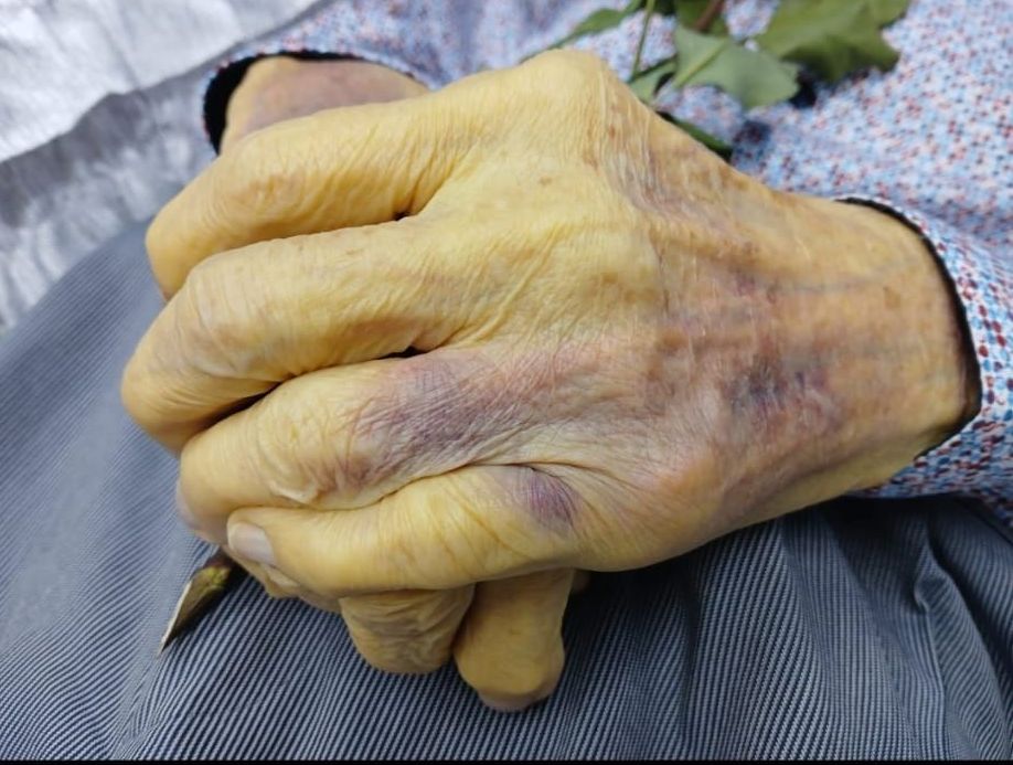 Eine Nahaufnahme der Hände einer älteren Person mit gelblicher Haut