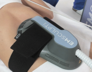 Un bout d'une machine d'e-sculpt.