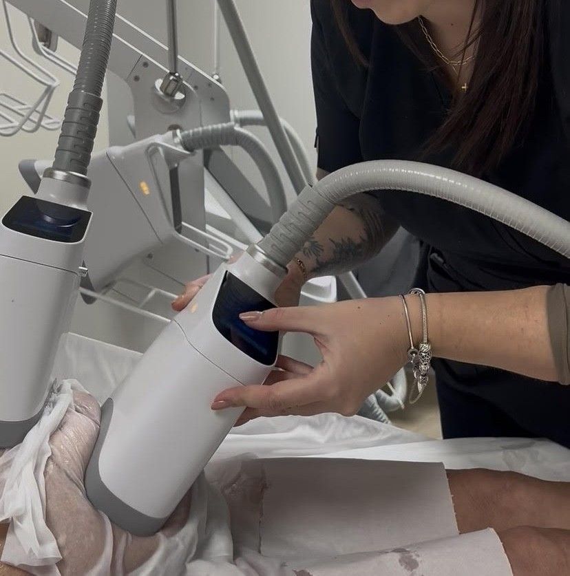 Appareil pour cryolipolyse.