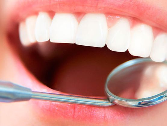 Una mujer se hace examinar los dientes por un dentista con un espejo.