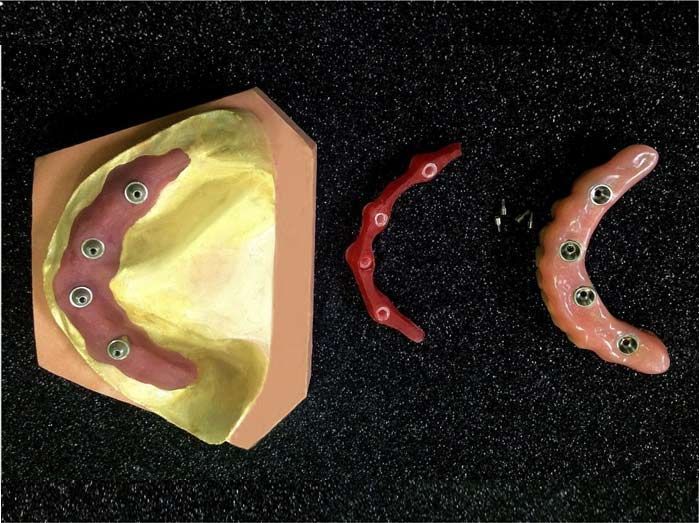 Un modelo de los dientes de una persona está sentado sobre una superficie negra.