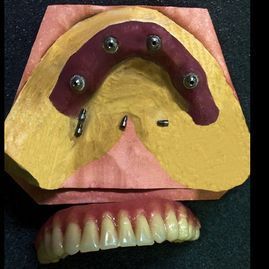Un primer plano de un modelo de una boca con dientes.