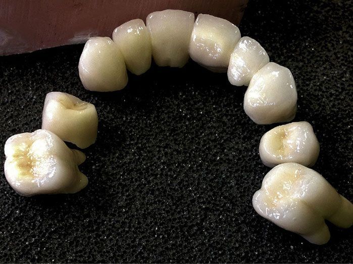 Un primer plano de una fila de dientes sobre una superficie negra.