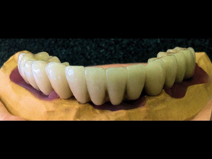 Un primer plano de un modelo de los dientes de una persona sobre una mesa.