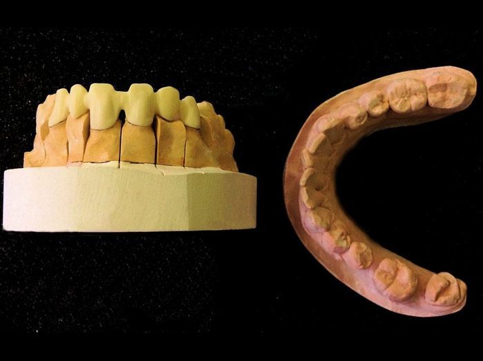 Un primer plano de un modelo de una boca con dientes.