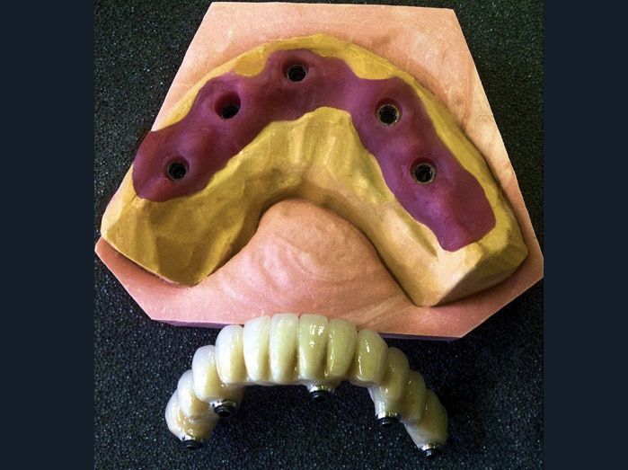 Un primer plano de un modelo de dientes sobre una mesa.