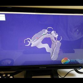 Un monitor de computadora muestra un modelo 3D de una prótesis dental.
