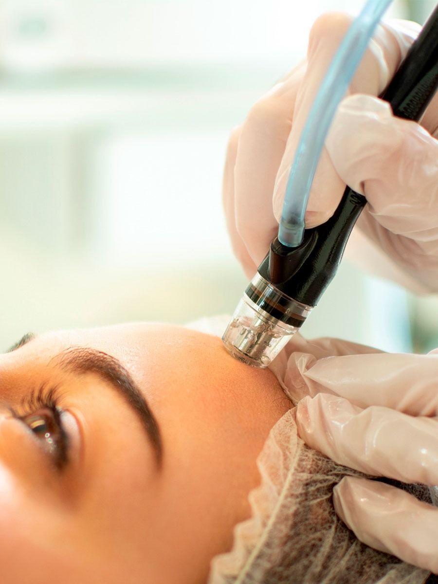 Una mujer está recibiendo un tratamiento facial con una máquina en su cara.