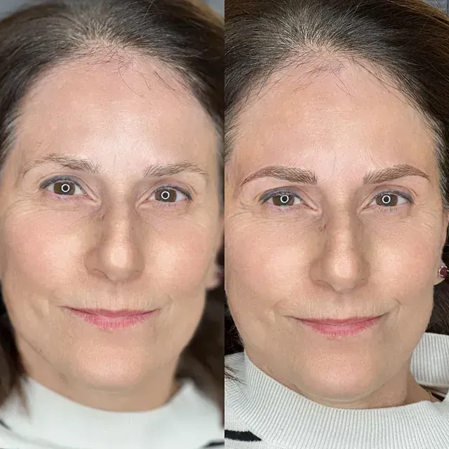 Una foto de antes y después de las cejas de una mujer.