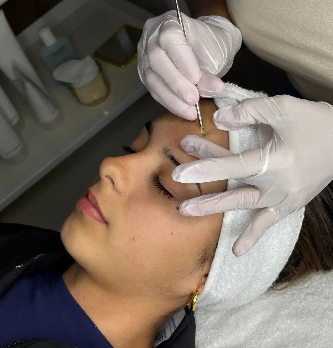Un profesional de la salud con guantes aplica un tratamiento en la frente de una mujer