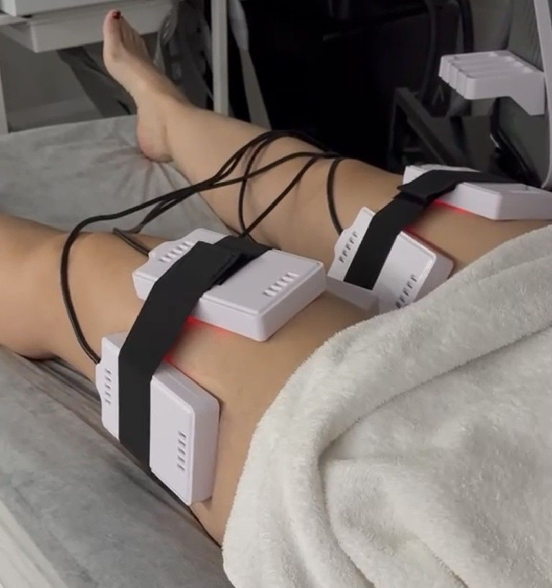 Piernas con sensores de electrodos colocados durante un procedimiento médico o terapéutico