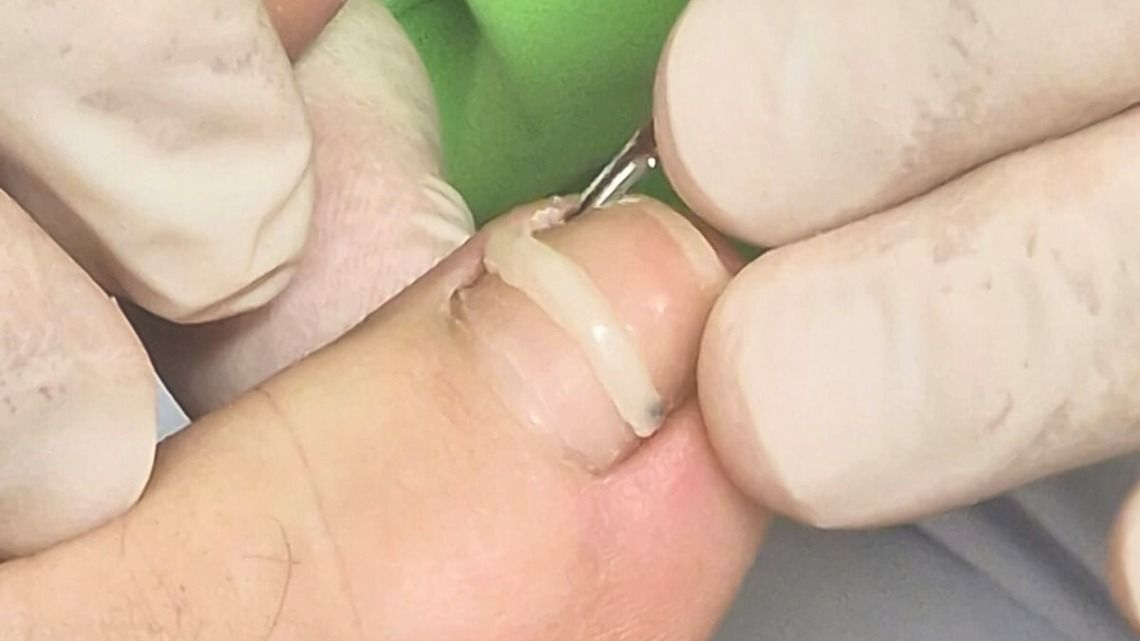 Una persona se corta las uñas con un par de tijeras.