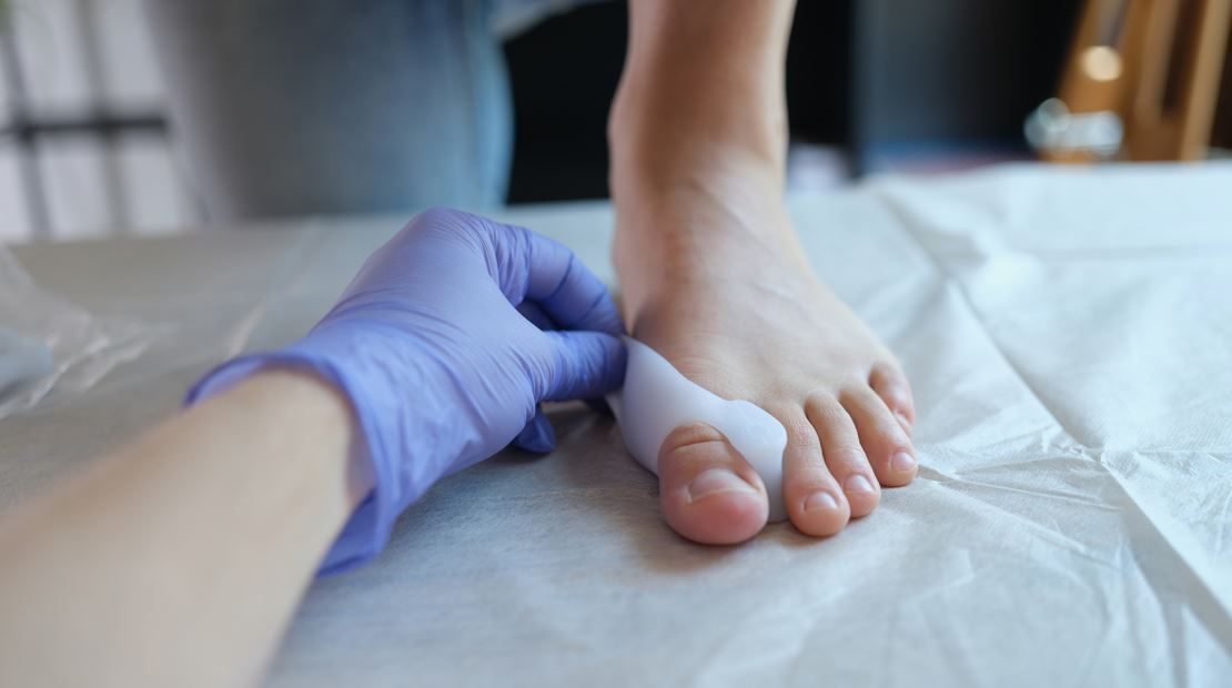 Se examina el pie de una persona que lleva un separador de dedos y es manipulado por alguien que lleva un guante morado.