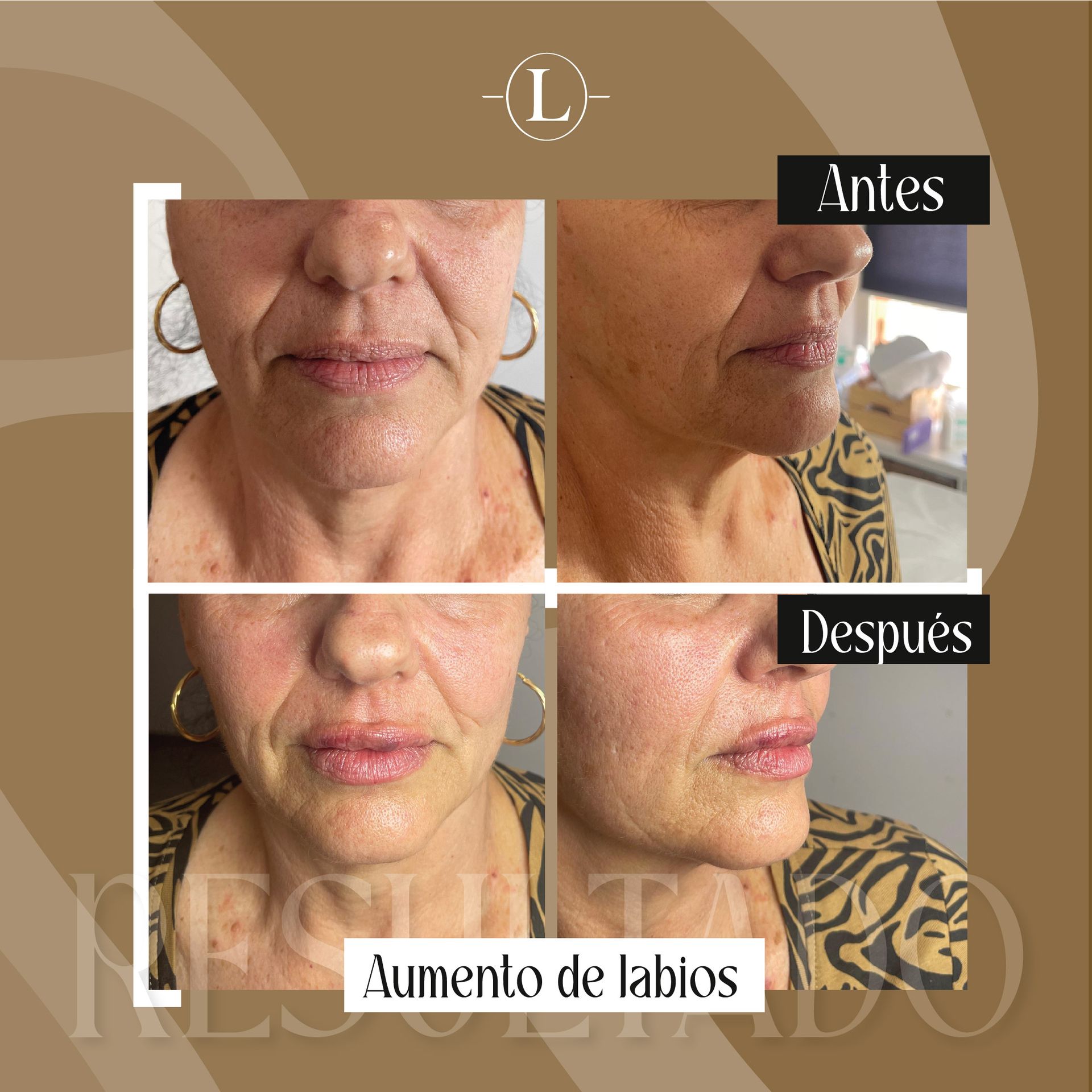 Una fotografía de antes y después del rostro de una mujer.