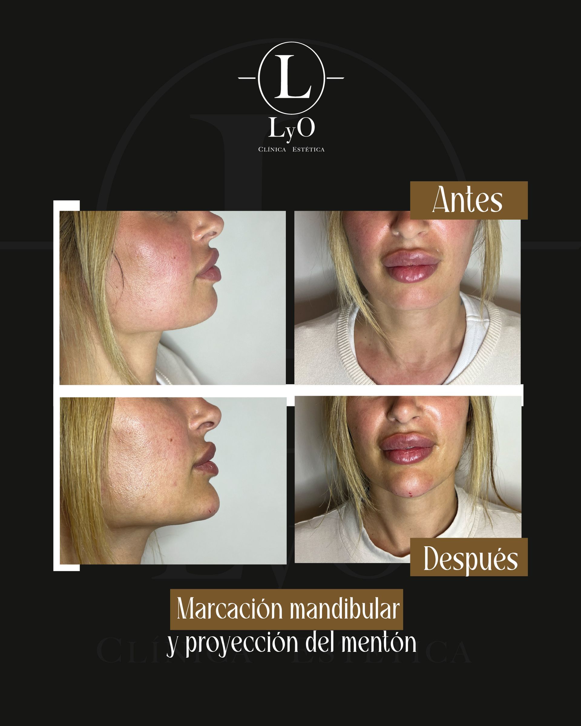 Una foto de antes y después del rostro de una mujer.