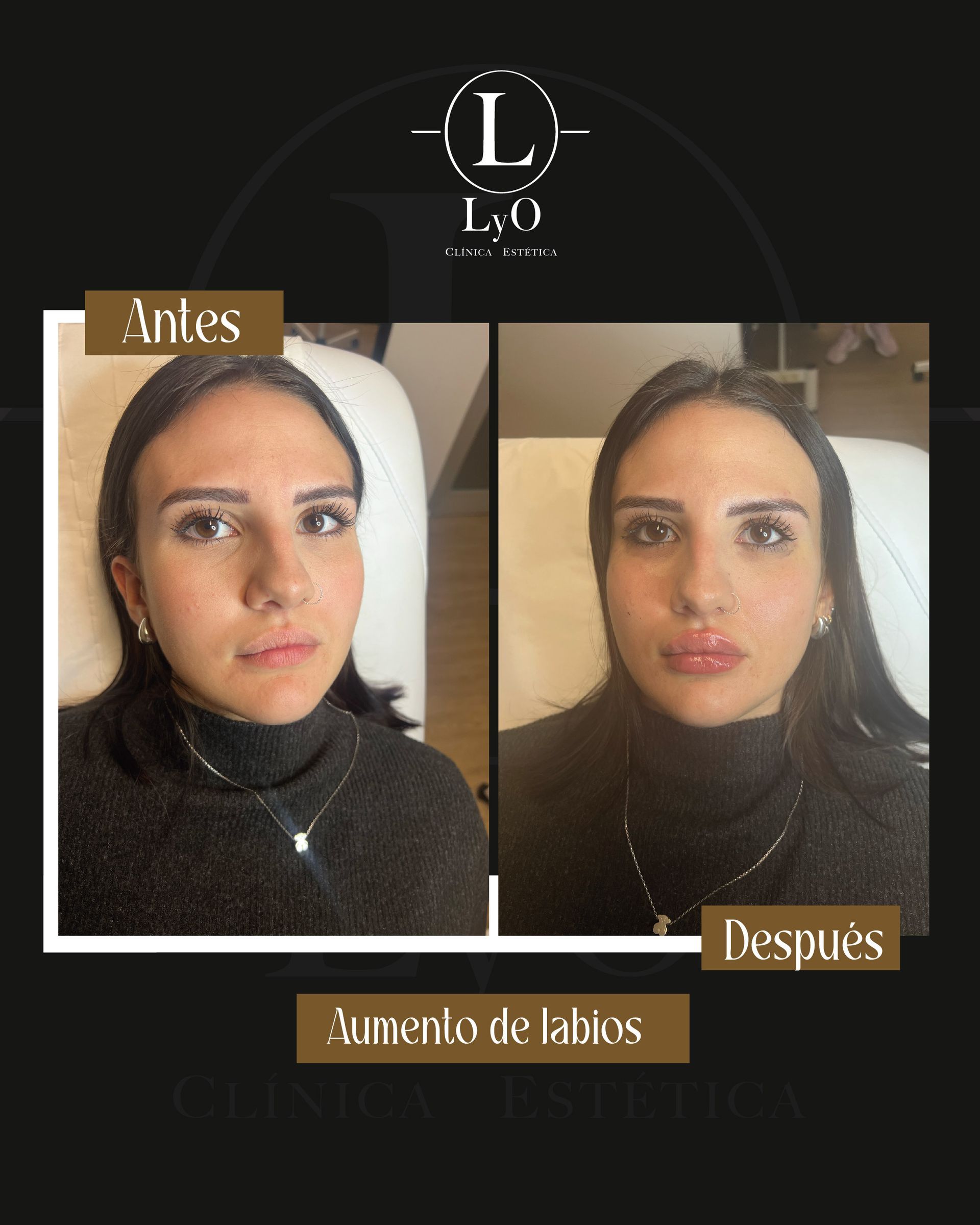 Una foto de antes y después del rostro de una mujer.