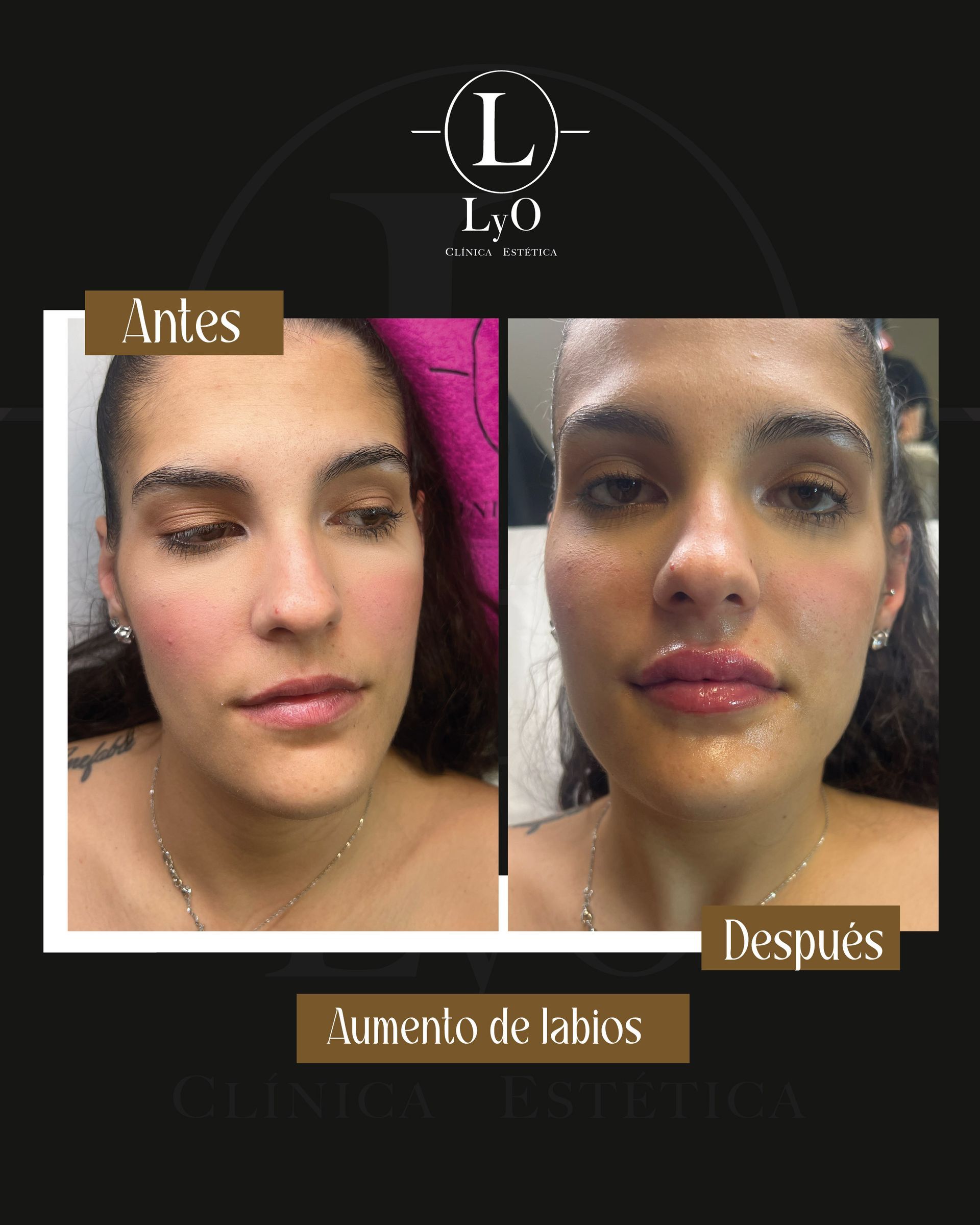 Una fotografía de antes y después del rostro de una mujer.