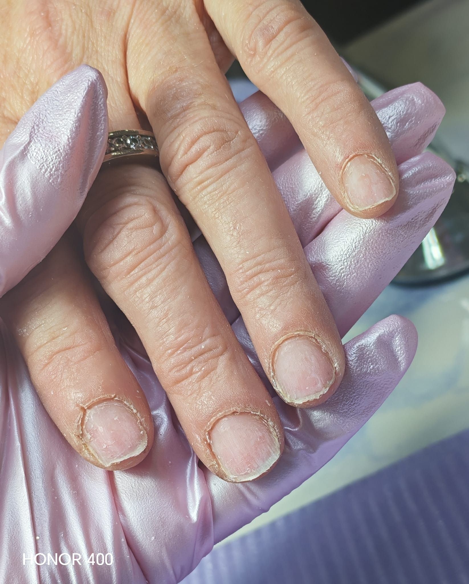 La mano de una persona, que lleva un anillo, es sostenida por una mano que lleva un guante texturizado de color lila claro.