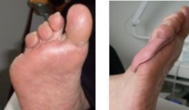 Orthesen von Podologie Garn in Heiligkreuz/Mels