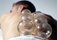 Ventouses -Vitta Santé - Médecine Traditionnelle Chinoise - Bulle