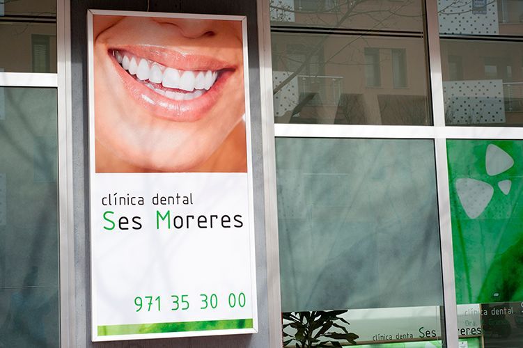 Un cartel de la Clínica Dental Ses Moreres tiene una imagen de la sonrisa de una mujer.