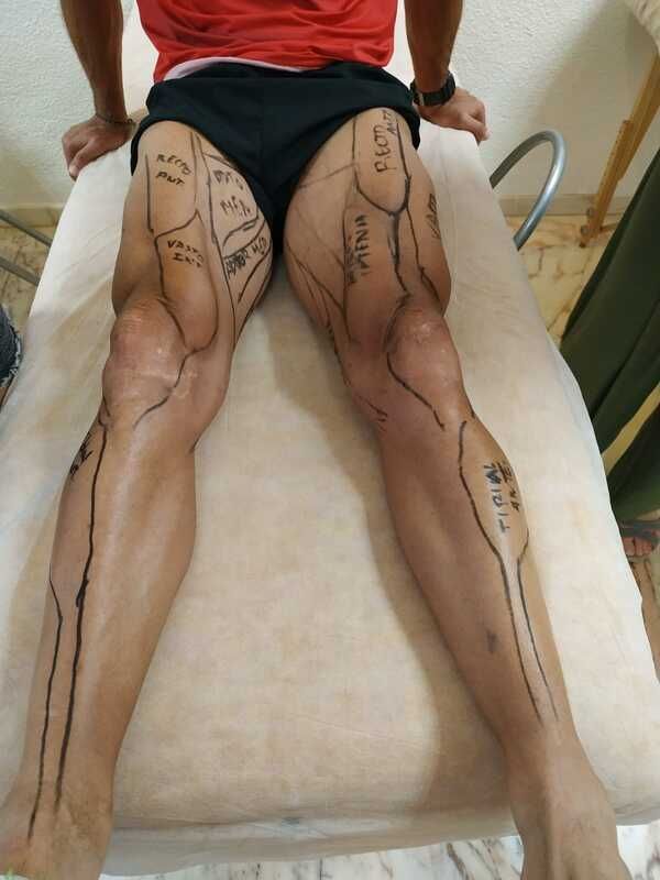Un hombre está sentado en una cama con dibujos en sus piernas.