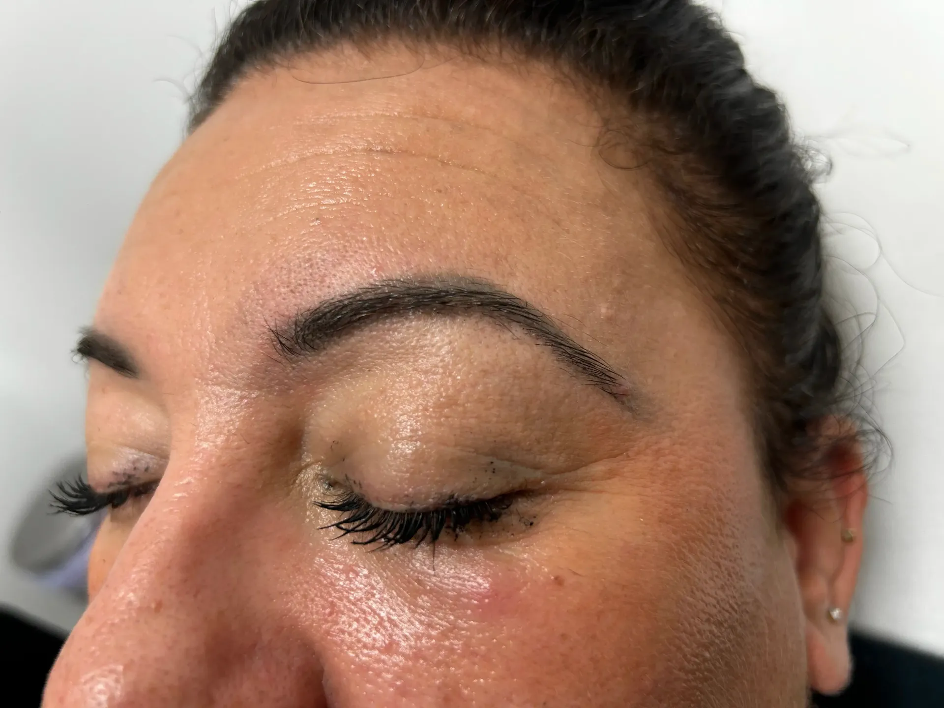 Persona recibiendo micropigmentación de labios; manos enguantadas del técnico, instrumento cerca de los labios.