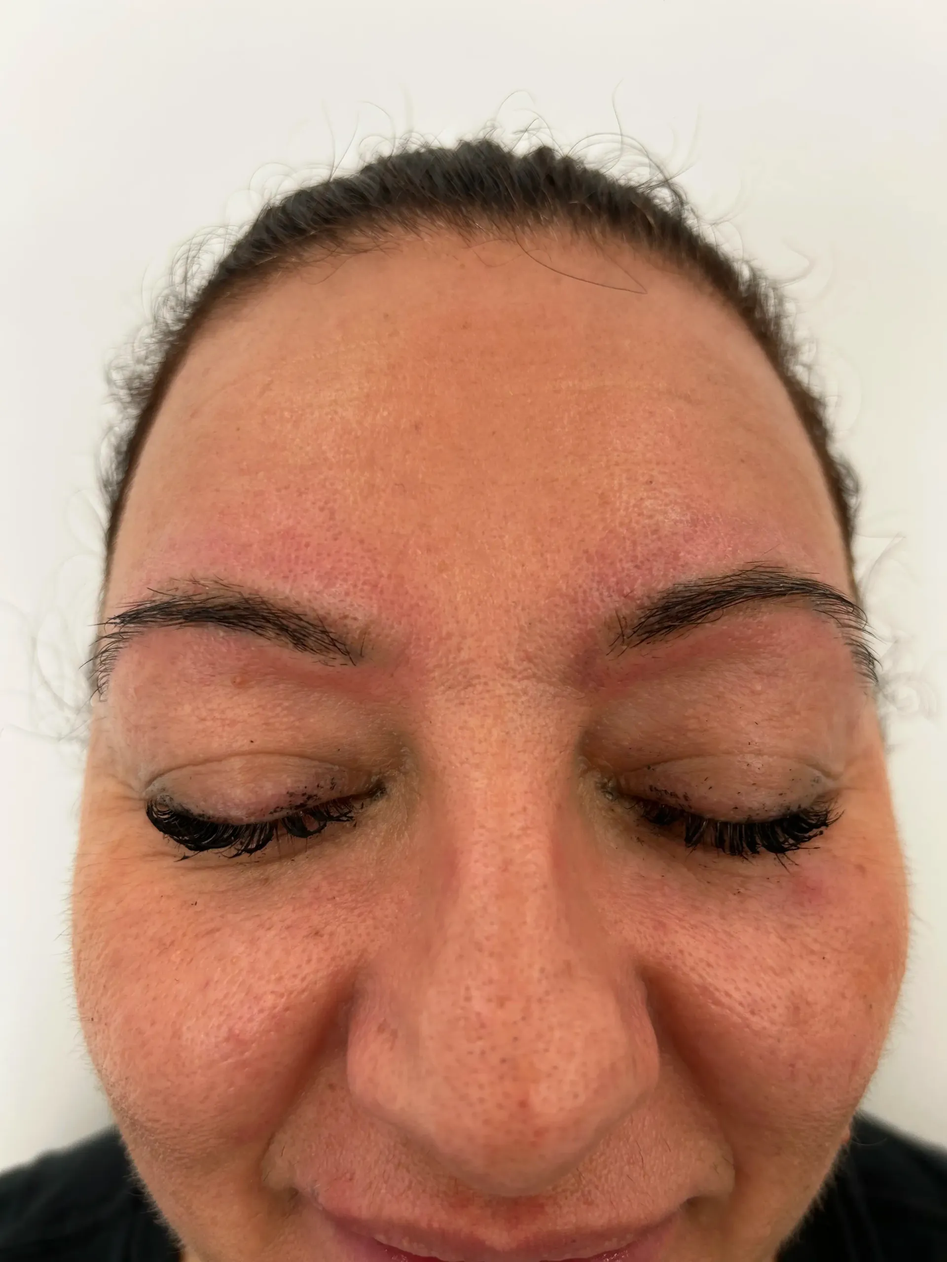 Persona recibiendo micropigmentación de labios; manos enguantadas del técnico, instrumento cerca de los labios.