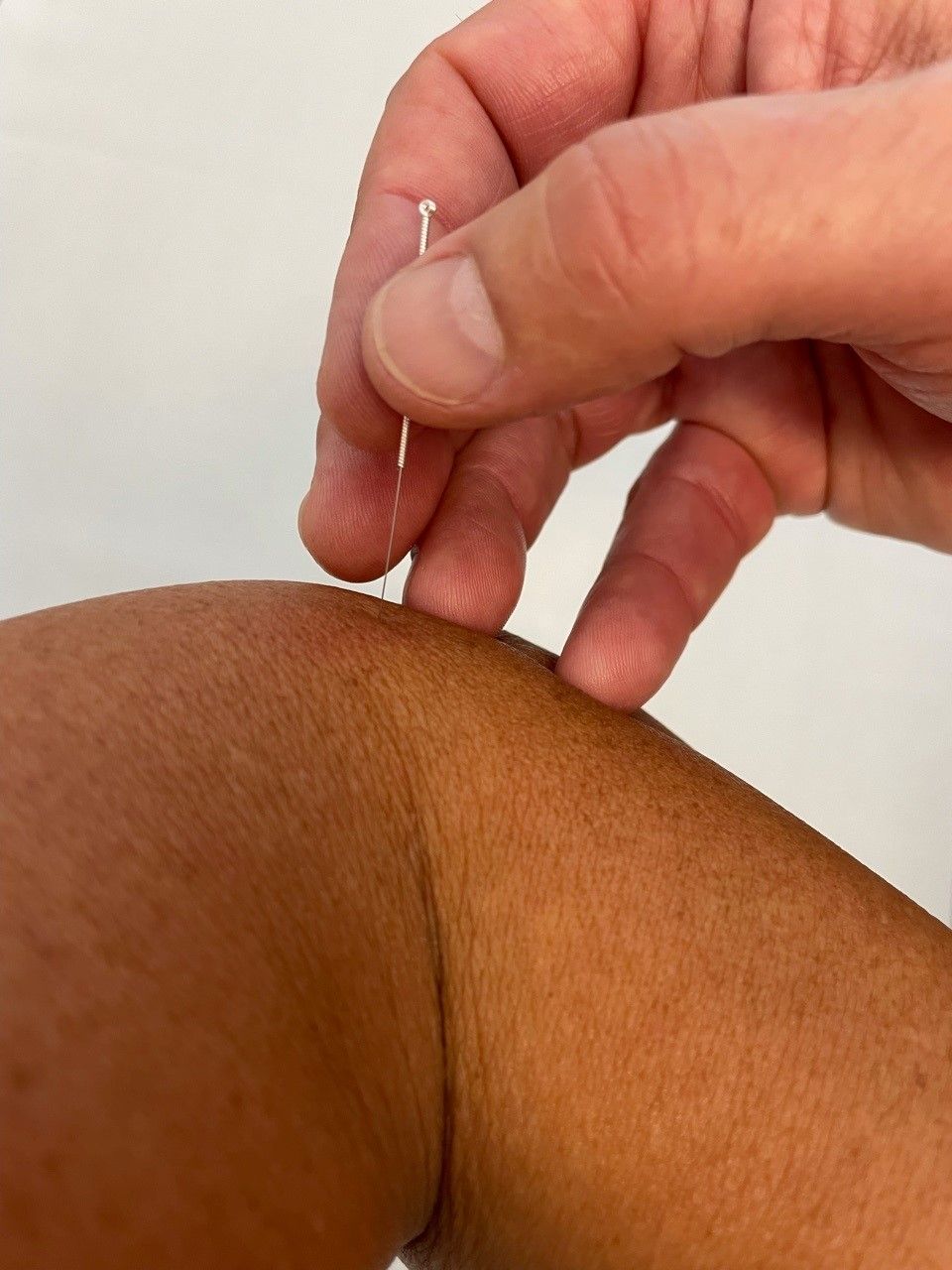 Jean-Marie Colmar - médecine alternative